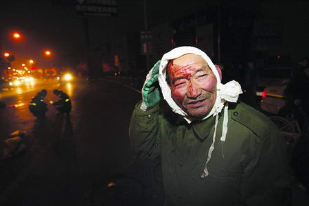 Injured man in car crash