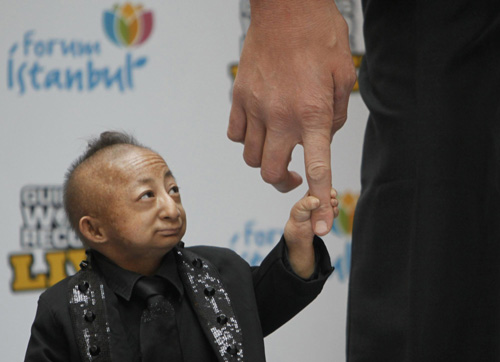 World's shortest man dies at 21