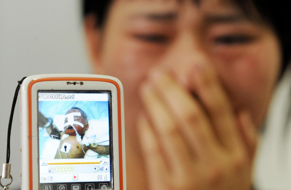 17 babies sickened by expired measles injections