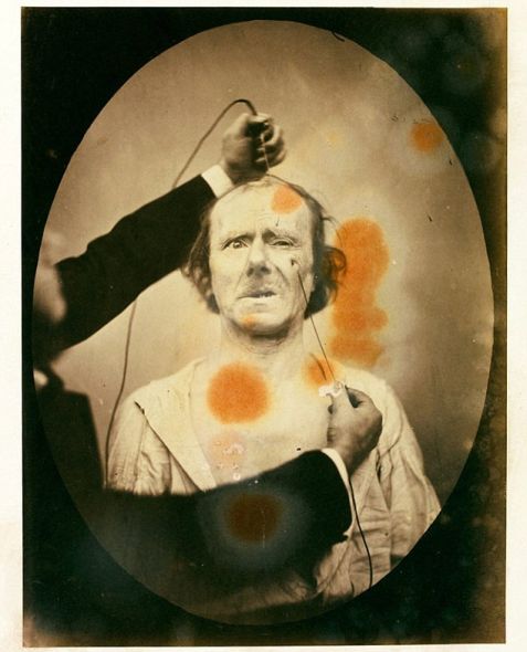 揭秘達爾文最后實驗:探索人類情緒表情扭曲