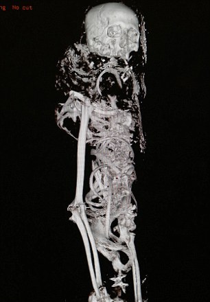4000歲木乃伊接受CT掃描 “理想患者”毫發無損