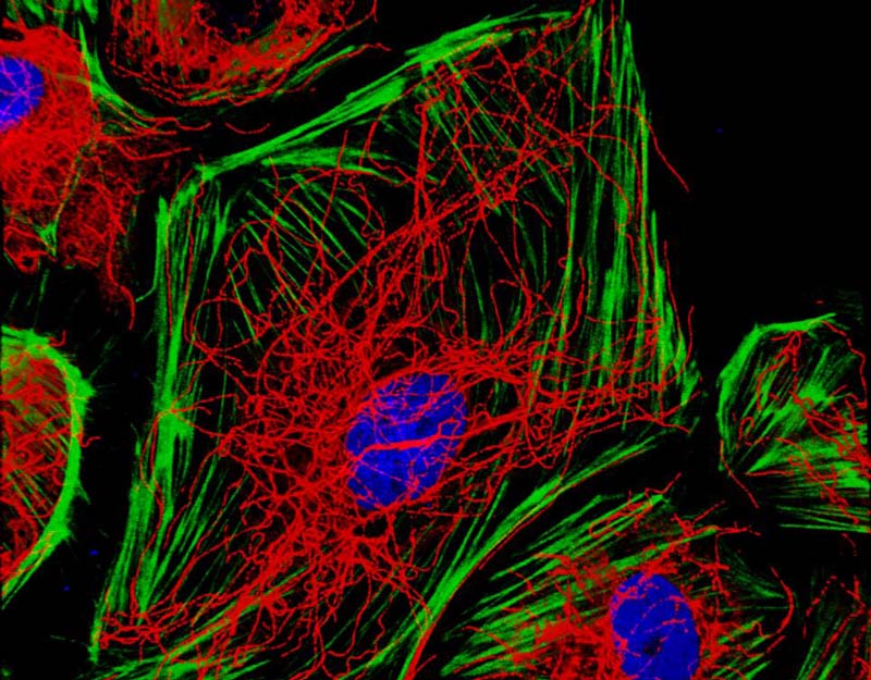 老鼠心臟醫學圖像變身絕美藝術品(高清)