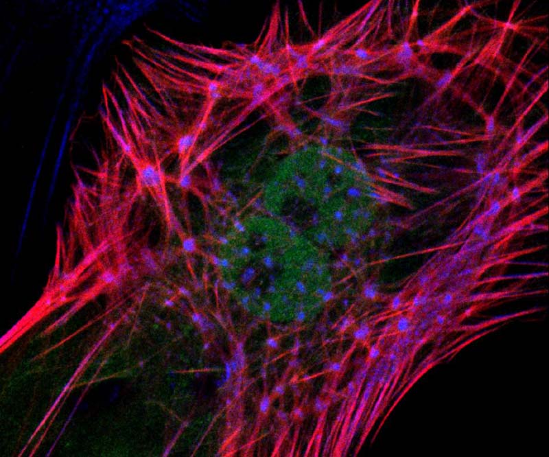 老鼠心臟醫學圖像變身絕美藝術品(高清)
