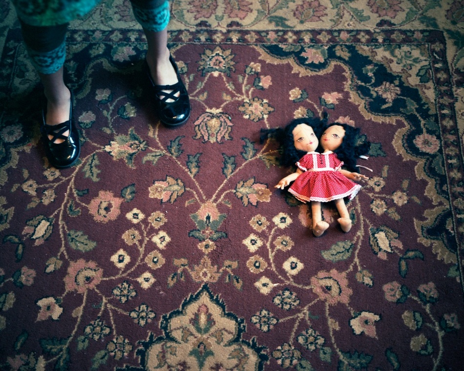 雙生之花：連體姐妹的異色世界(組圖)