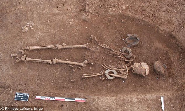 法國發現1650年前貴族頭骨：嚴重畸形呈錐形(組圖)