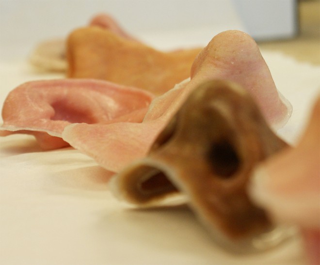 外部創傷患者福音：3-D打印鼻子、耳朵誕生