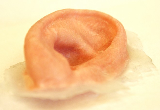 外部創(chuàng)傷患者福音：3-D打印鼻子、耳朵誕生