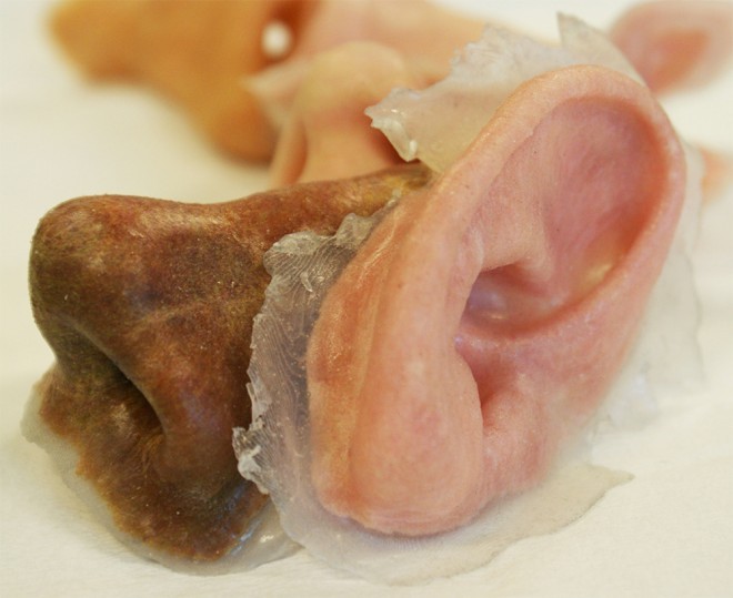 外部創(chuàng)傷患者福音：3-D打印鼻子、耳朵誕生