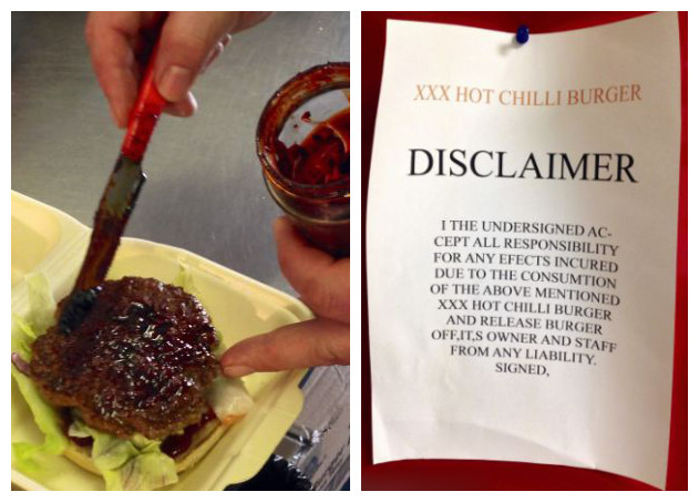英餐廳推出超辣漢堡已致5人住院(組圖)