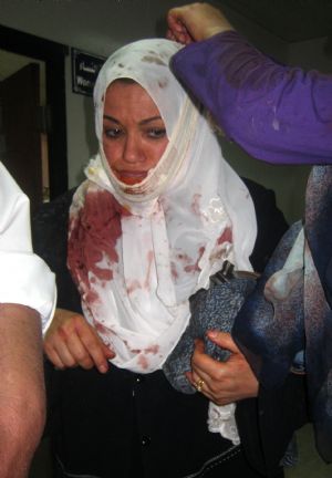 60 killed in Iraqi double bombing