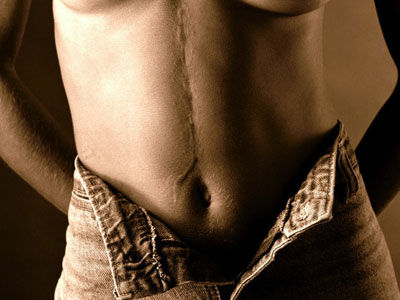 十種小病可能會要你的命（組圖）