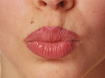 十種小病可能會要你的命（組圖）