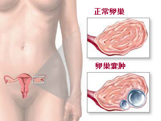 警惕:八種生活習(xí)慣可能招來(lái)癌癥(圖)